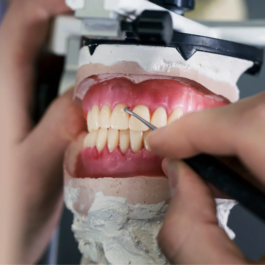 Dermatologia em João Pessoa - Próteses Dentárias
